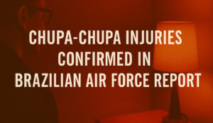 chupa uap